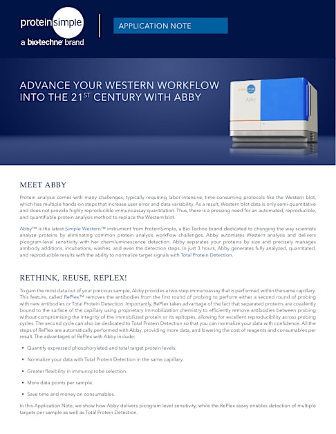 Advance your Workflow - Abby